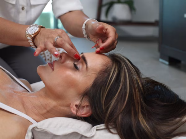 Cosmetische acupunctuur